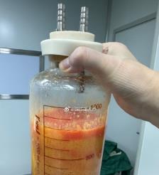 仁寿水动力吸脂手术要做多久？